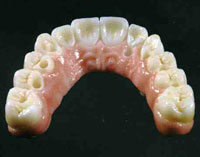 Advanced Dental Prosthetics